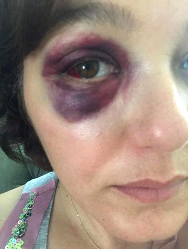 Kadıköy'de Saldırgan, 