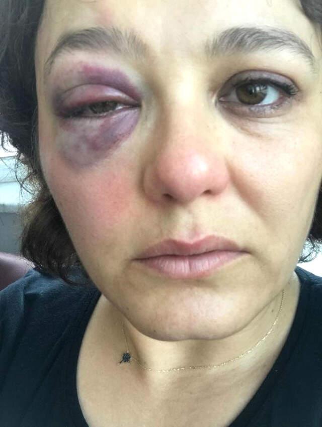 Kadıköy'de Saldırgan, 