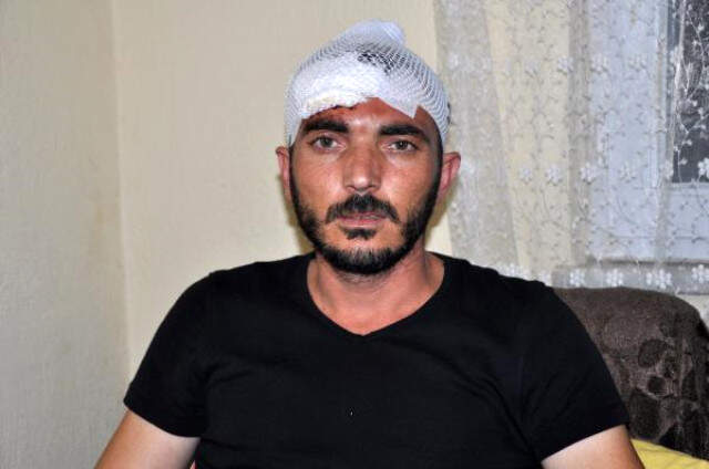 Esnaf, Yeğeninin Olayı İle İlgili Polise ''Nasıl Oldu'' Diye Sorunca Tekme <a class='keyword-sd' href='/tokat/' title='Tokat'>Tokat</a> Dayak Yedi
