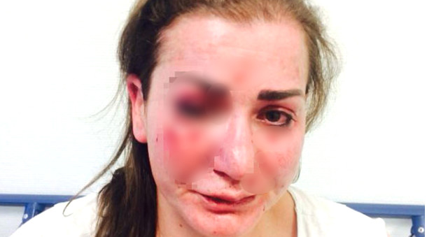 Almanya'da Tramvayla İşe Giden Türk Kadın Saldırıya Uğradı