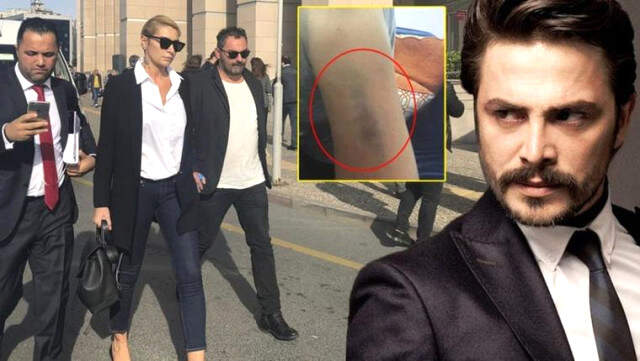 Sıla'yı Darp Ettiği İddiasıyla İfade Veren Ahmet Kural, Adliye Çıkışı Soruları Yanıtsız Bıraktı Sıla'yı Darp Ettiği İddiasıyla İfade Vermeye Adliyeye Gelen Ahmet Kural, Soruları Yanıtsız Bıraktı