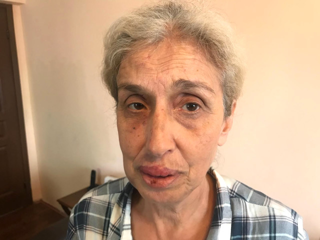 Yaşlı Kadın, Hayvan Beslediği İçin Sokak Ortasında Ölesiye Dövüldü