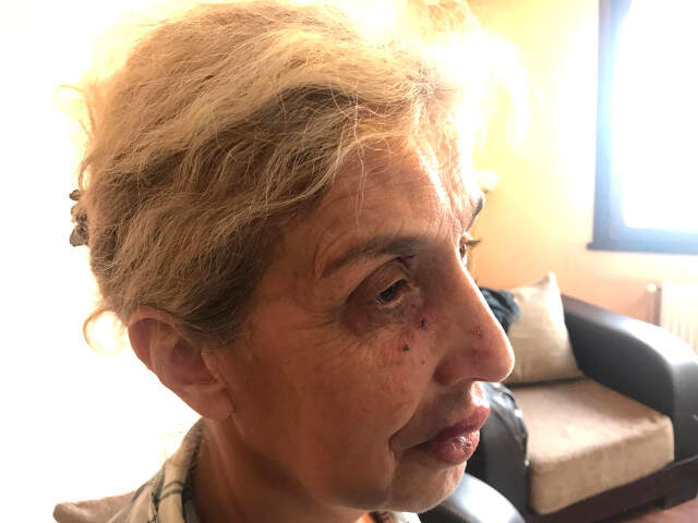Yaşlı Kadın, Hayvan Beslediği İçin Sokak Ortasında Ölesiye Dövüldü