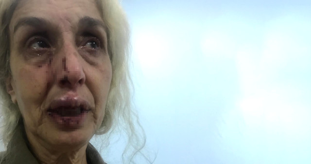 Yaşlı Kadın, Hayvan Beslediği İçin Sokak Ortasında Ölesiye Dövüldü