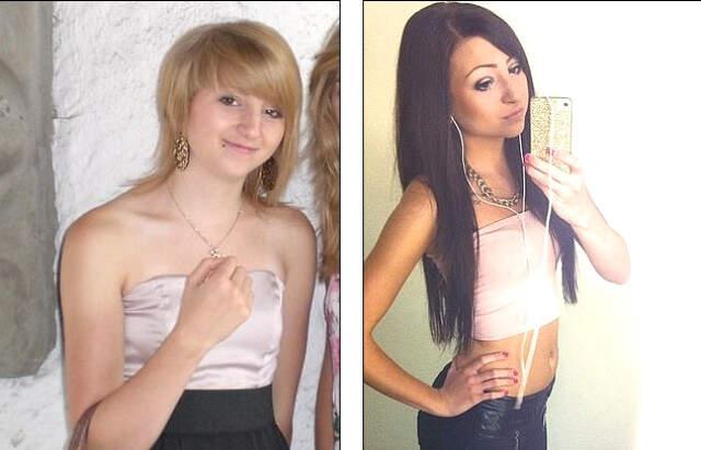 Arkadaşlarının Alay Ettiği Genç Kız, 40 Bin Dolar Harcayarak Başka Biri Oldu