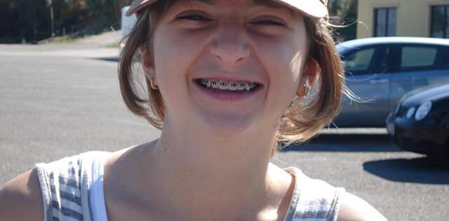 Arkadaşlarının Alay Ettiği Genç Kız, 40 Bin Dolar Harcayarak Başka Biri Oldu