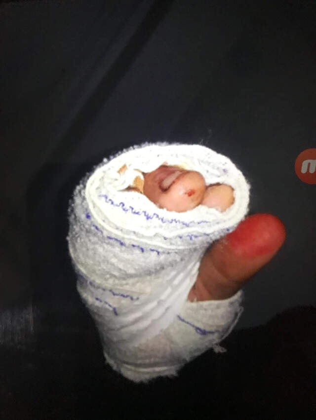 Kaçırdıkları Gencin Babasından 50 Bin Dolar Fidye İstediler Kesik Parmak Süsü Verip Suriyeli Babadan 50 Bin Dolar Fidye İstediler