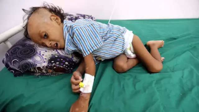 Yemen'de Taraflar 'Çatışmasızlık' Sözünü Tutmadı: Liman Kenti Hudeyda'da Çatışmalar Sürüyor