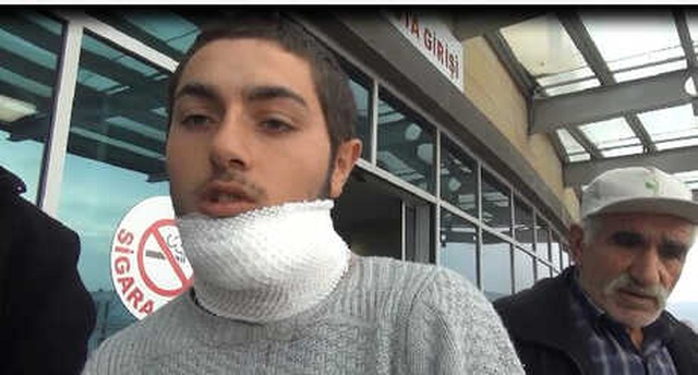 Genç Adam, Yardım Etmek İstediği Madde Bağımlısı Gencin Saldırısına Uğradı