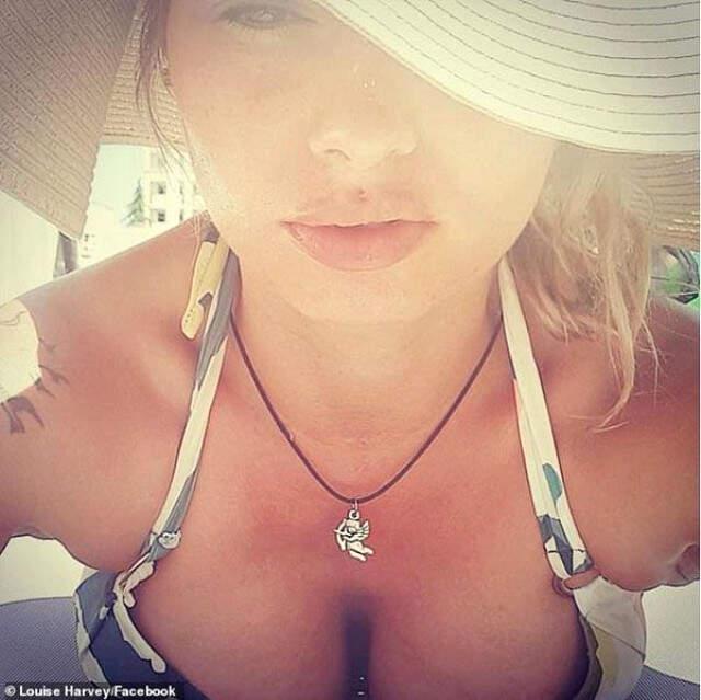 Gögüslerini Büyültme Operasyon Geçiren Genç Anne Hayatını Kaybetti Göğüslerini Büyütme Operasyonu Geçiren Genç Anne, Hayatını Kaybetti