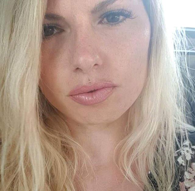 Gögüslerini Büyültme Operasyon Geçiren Genç Anne Hayatını Kaybetti Göğüslerini Büyütme Operasyonu Geçiren Genç Anne, Hayatını Kaybetti