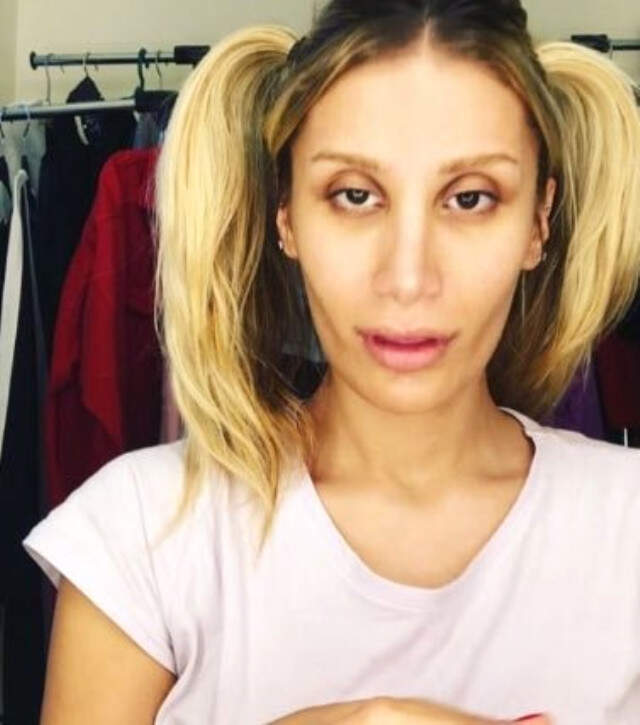 Şarkıcı İrem Derici, Burun Estetiklerine 30 Bin, Göğüsleri İçin de 4 Bin Euro Harcamış