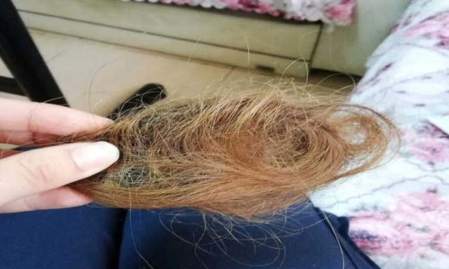 Hasta Yakını Genç Kız, Sağlık Çalışanını Darp Edip Saçını Kopardı