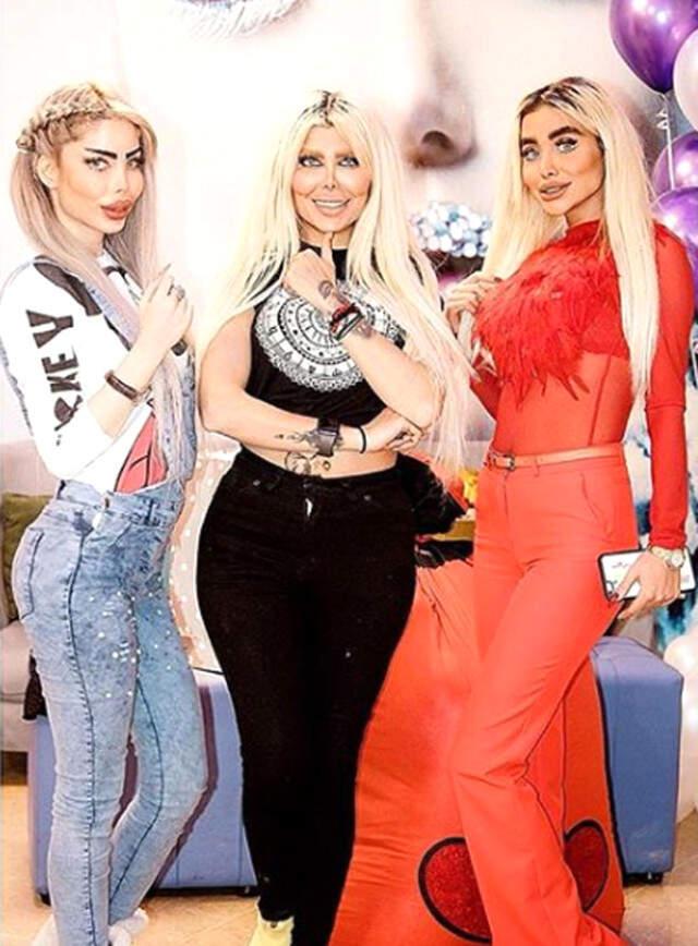 İran'da Kırbaç Cezası Verilmesine Rağmen Estetiğin Önüne Geçilemiyor!