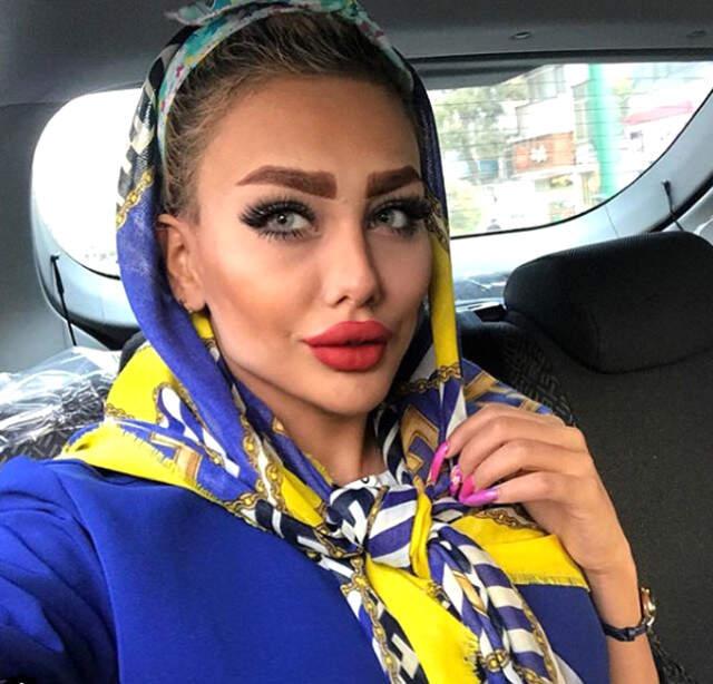 İran'da Kırbaç Cezası Verilmesine Rağmen Estetiğin Önüne Geçilemiyor!