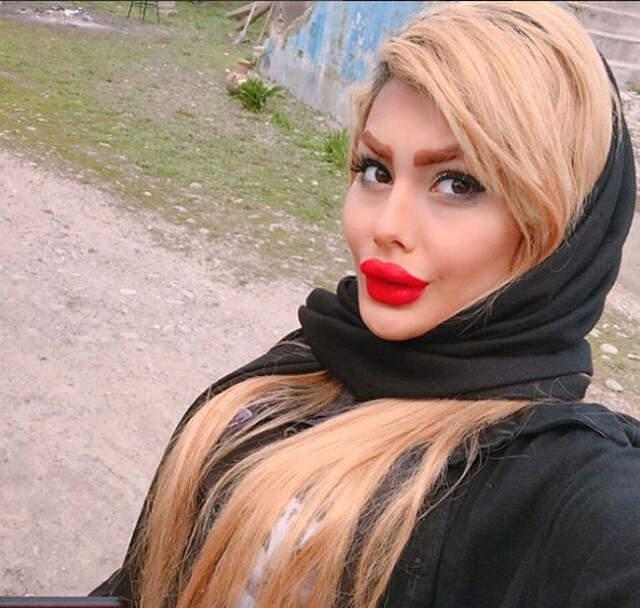 İran'da Kırbaç Cezası Verilmesine Rağmen Estetiğin Önüne Geçilemiyor!