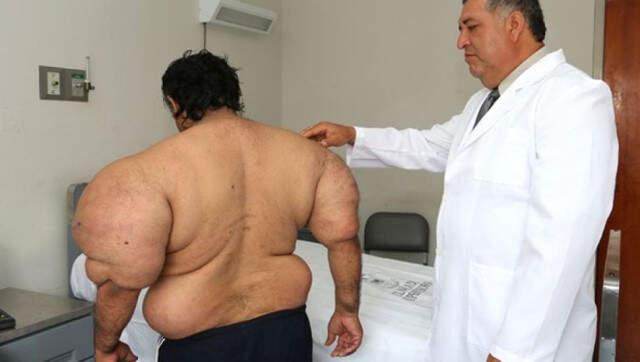 Açık Denizde Vurgun Yiyen Dalgıç, Temel Reis'e Benzedi