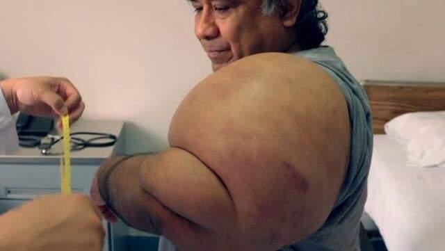 Açık Denizde Vurgun Yiyen Dalgıç, Temel Reis'e Benzedi