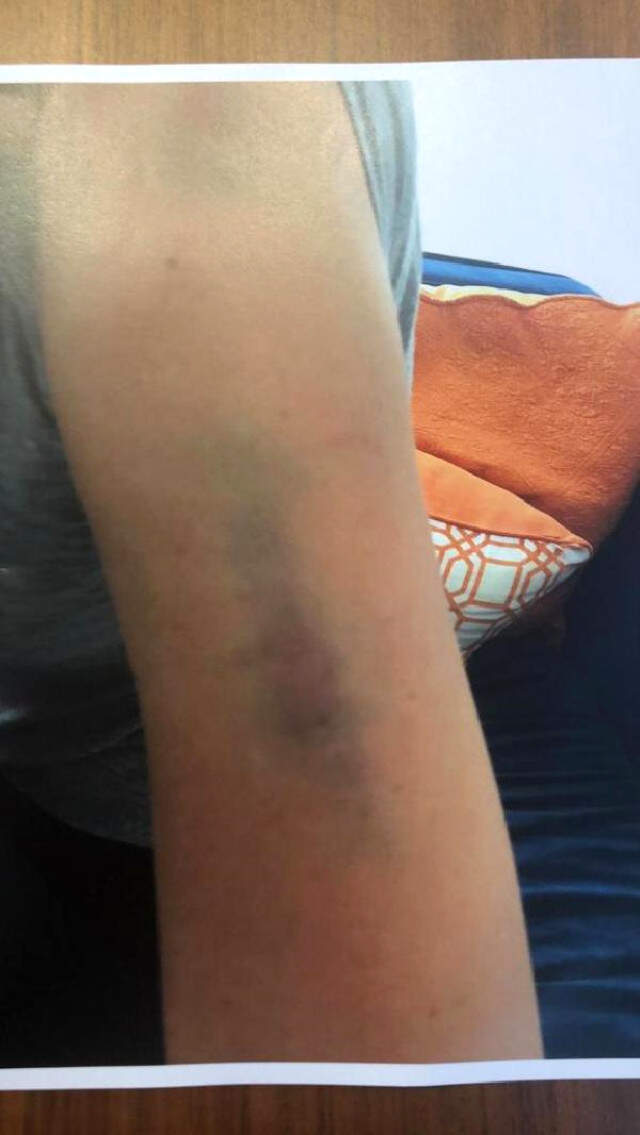 5 Yıl Hapsi İstenen Ahmet Kural ve Sıla'nın Kavgasının Detayları Ortaya Çıktı: Gömleğinde Kan Vardı 5 Yıl Hapsi İstenen Ahmet Kural ve Sıla'nın Kavgasının Detayları Ortaya Çıktı: Gömleğinde Kan İzi Vardı