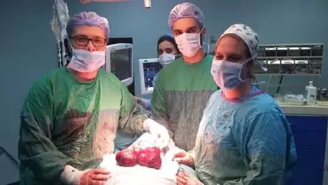 Ameliyattan Korkan Kadının Boynundan 1 Kilo 100 Gram Ağırlığında Guatr Çıkarıldı