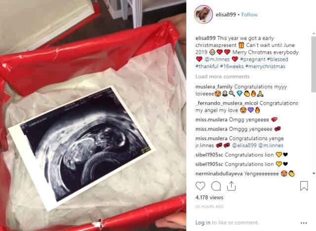 Galatasaray'ın Norveçli Oyuncusu Martin Linnes İkinci Kez <a class='keyword-sd' href='/baba/' title='Baba'>Baba</a> Oluyor