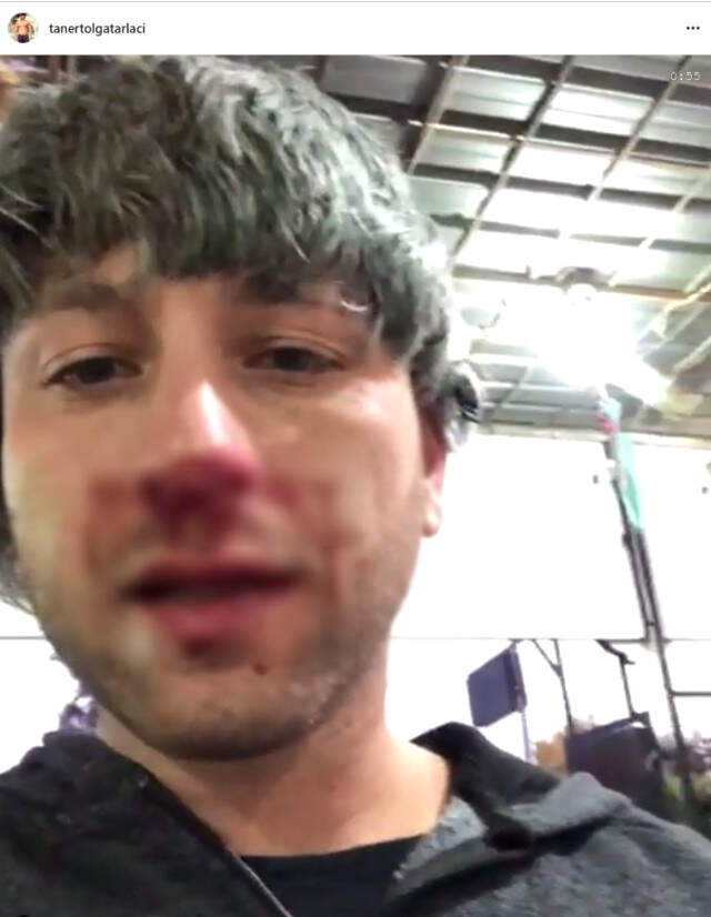 Survivor'un Eski Yarışmacısı Taner Tolga Tarlacı, 25 Kişinin Saldırısına Uğradı