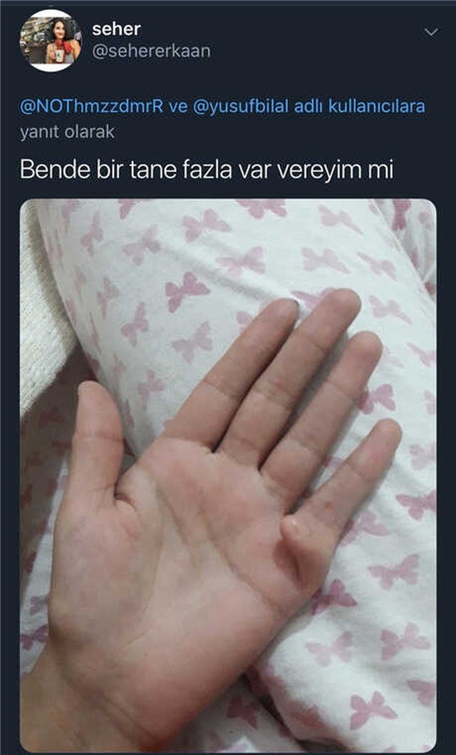 Burası Twitter: 4 Parmağım Var Diyene 6 Parmaklıdan Teklif Geldi