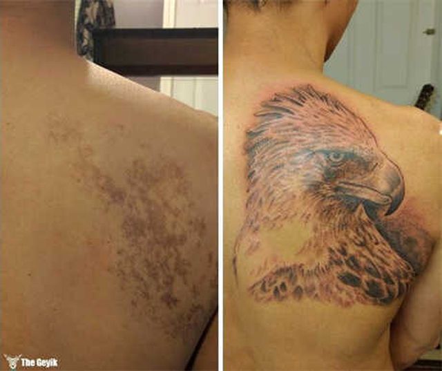 Doğum Lekesini Kreatif Bir Dövmeyle Kapatmış 15 Kişi