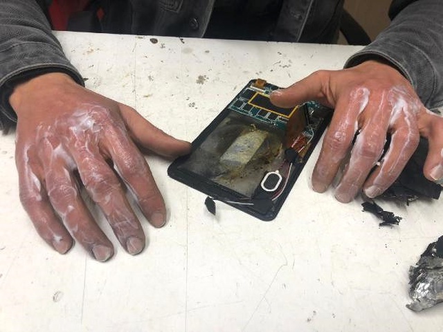 Tamir Ettiği Tablet Patladı, İki Eli ve Kulağı Yandı