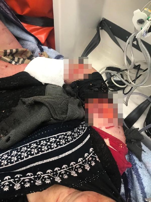 Kayseri'den Sonra Kırşehir'de de Sokak Köpeklerinin Saldırdığı Kadın Ağır Yaralandı