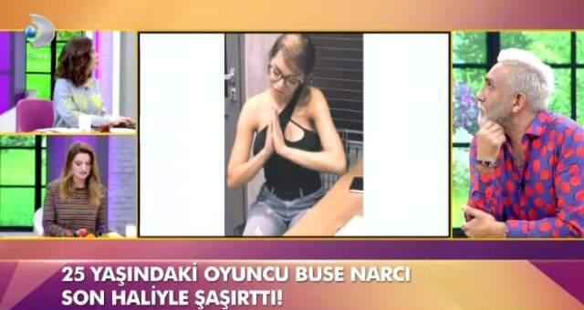 Özcan Deniz'in Eski Aşkı Buse Narcı'nın Saçları Döküldü