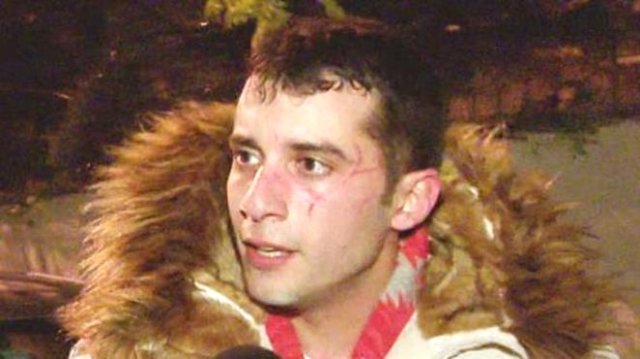 Ünlü Türkücü İzzet Altınmeşe'nin Oğlu Fırat Altınmeşe, Sevgilisinin Saldırısına Uğradı
