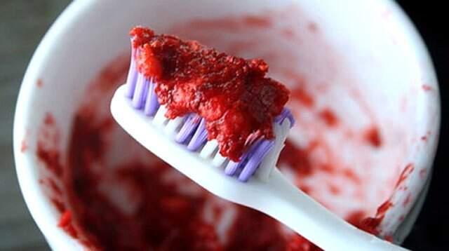 Gülüşünüzü Mükemmelleştiren 7 Yöntem Gülüşünüzü Mükemmelleştiren 7 Yöntem