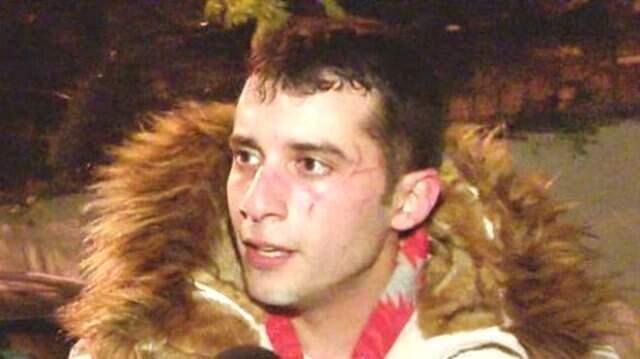 Sevgilisinin Saldırısına Uğrayan Fırat Altunmeşe'nin, Yüzündeki İzlerden Dolayı Set Durdu