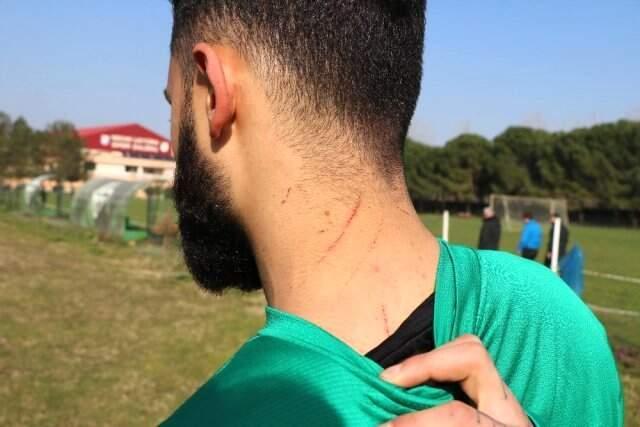 Sakaryasporlu Futbolcular, Amedspor Maçında Yaşadıklarını Anlattı Sakaryasporlu Futbolcular, Amedspor Maçında Yaşadıklarını Anlattı