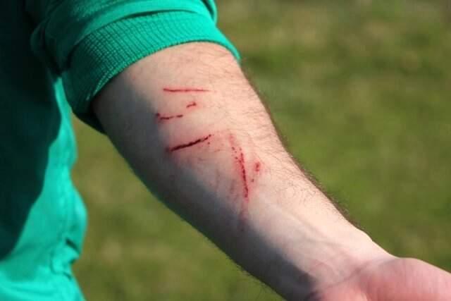 Sakaryasporlu Futbolcular, Amedspor Maçında Yaşadıklarını Anlattı Sakaryasporlu Futbolcular, Amedspor Maçında Yaşadıklarını Anlattı