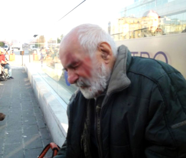 Ünlü Oyuncu Hikmet Karagöz, Taksim'de Yürüyen Merdivenden Düşerek Yaralandı