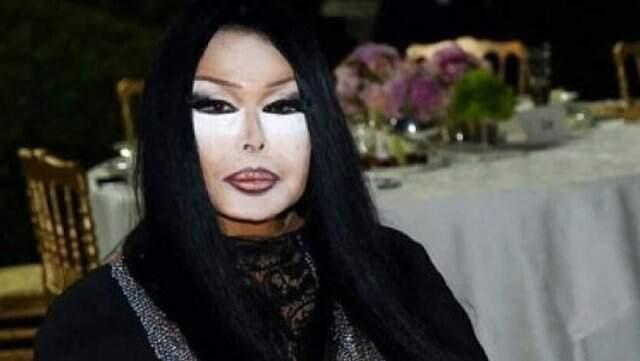 Usta Sanatçı Bülent Ersoy, Zatürre Oldu!
