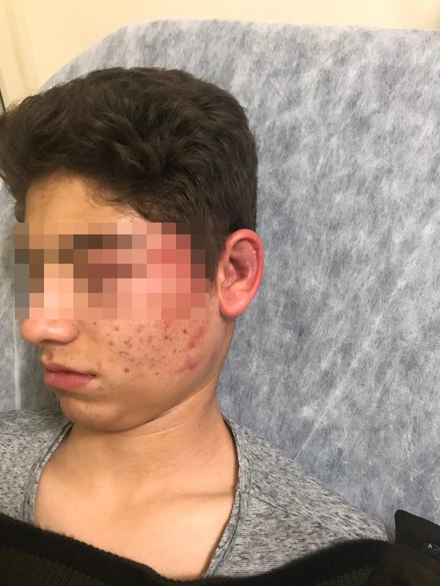 Kız Arkadaşının Eski Sevgilisini Boks Makinesi Yerine Koyup Dövdü, Arkadaşı Videoya Çekti
