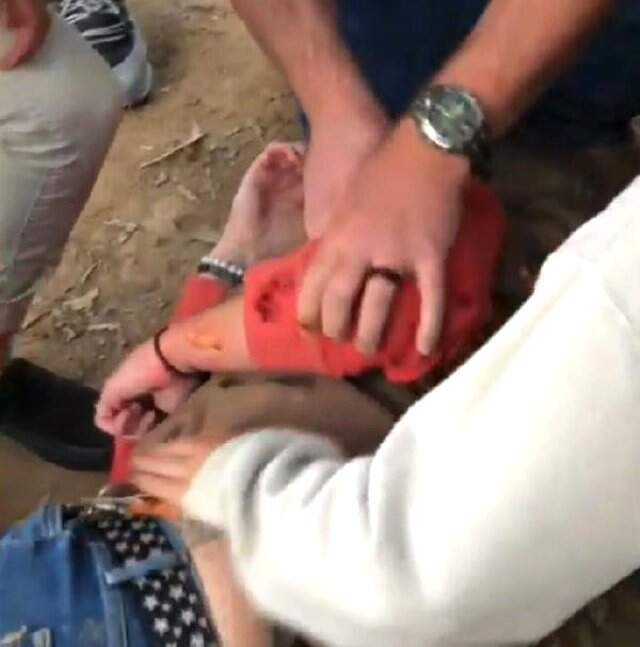 Selfie Yapmak İsterken Jaguarın Saldırısına Uğradı Selfie Çekmek İsteyen Ziyaretçi, Jaguarın Saldırısına Uğradı