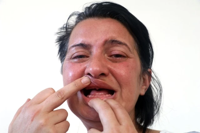 Delirten Hastalık Nedeniyle Ötenazi İsteyen Kadının Yüzü Artık Gülüyor