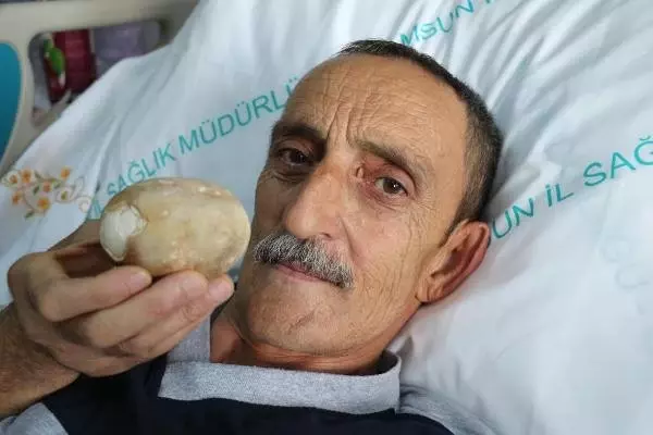 İdrarını Yapamayan Vatandaşın Mesanesinden 522 Gramlık Tek Parça Taş Çıktı
