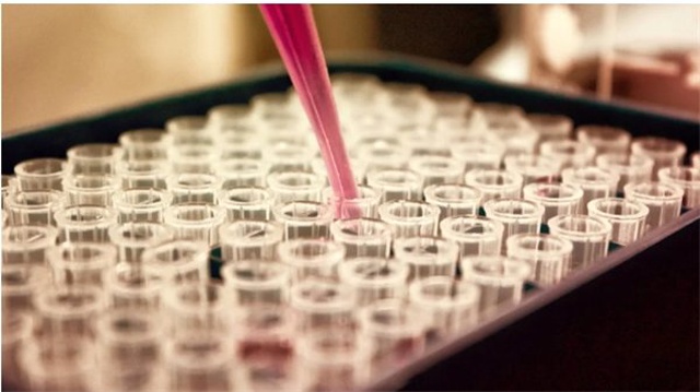 Family Tree Dna Şirketi, Elindeki Dna Verilerini Fbı ile Paylaşmaya Devam Edeceklerini Açıkladı
