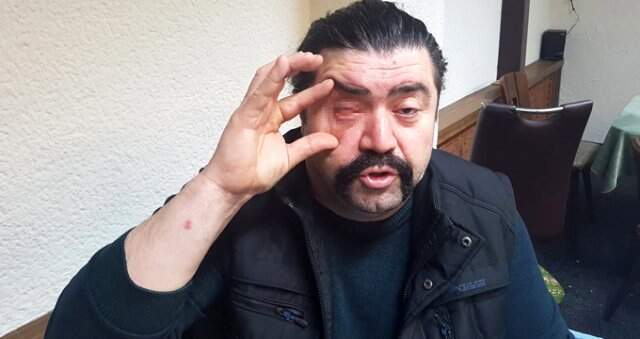 Asker Uğurlamasında Terör Estiren Saldırganlar Tartıştıkları Adamın Gözünü Çıkardı Asker Uğurlamasında Vahşet: Konvoydakiler Üstüne Atlayıp Gözünü Çıkardı! Kamera Kayıttaydı