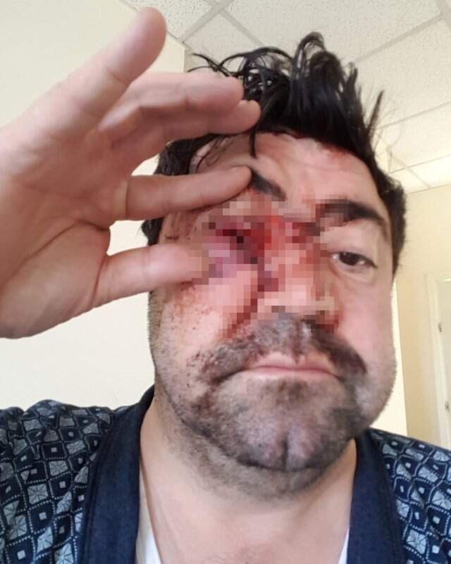 Asker Uğurlamasında Terör Estiren Saldırganlar Tartıştıkları Adamın Gözünü Çıkardı Asker Uğurlamasında Vahşet: Konvoydakiler Üstüne Atlayıp Gözünü Çıkardı! Kamera Kayıttaydı