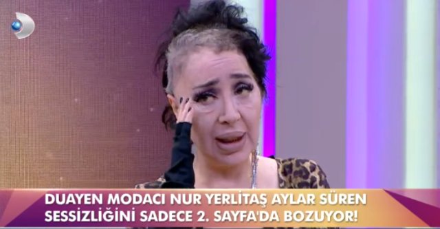 Modacı Nur Yerlitaş, Ameliyatlar Sonrası Haliyle Takipçilerini Üzdü!