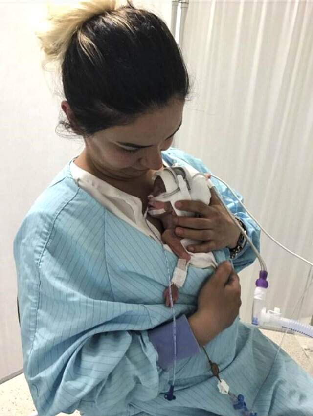 Korkunç Kazada Hamile Kadın Prematüre Doğum Yaptı! Alkollü Sürücü Kusurlu Bulunmadı Korkunç Kazada Hamile Kadın Prematüre Doğum Yaptı! Alkollü Sürücü Kusurlu Bulunmadı