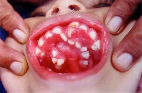 İnsan Anatomisinde Alışılmışın Dışında Gelişen 5 Farklı Özellik