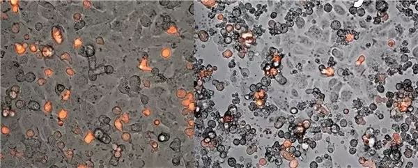 3 Türk Bilim İnsanı, Kansere Karşı Savaşçı Hücreler Ürettiler