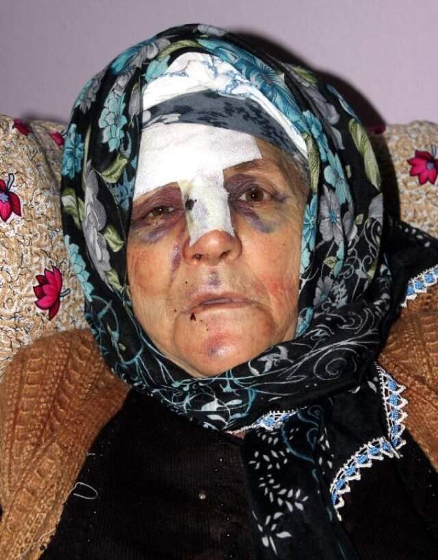 Yaşlı Kadının Parmağını Kırıp Yüzüğünü Gasbeden Komşuya 13,5 Yıl Hapis Yaşlı Kadının Parmağını Kırıp Yüzüğünü Çalan Cani Komşunun Cezası Belli Oldu!